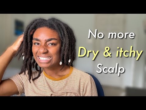 STARTER LOC JOURNEY TIPS- How To Get Rid of Dry, Itchy Scalp