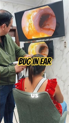 Cockroach Crawled Inside His Ear While Sleeping #facts #insects #scaryfacts