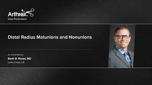 Distal Radius Malunions and Nonunions Augmented With ArthoCell™ Viable Cellular Bone Graft