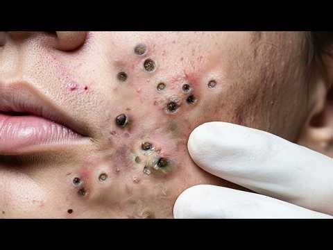 𝑨𝒄𝒉𝒊𝒆𝒗𝒆 𝑰𝒏𝒏𝒆𝒓 𝑷𝒆𝒂𝒄𝒆 𝑾𝒊𝒕𝒉 𝑻𝒉𝒆𝒔𝒆 𝑭𝒂𝒄𝒊𝒂𝒍 𝑪𝒍𝒆𝒂𝒏𝒔𝒊𝒏𝒈 𝑴𝒆𝒕𝒉𝒐𝒅𝒔 #90083