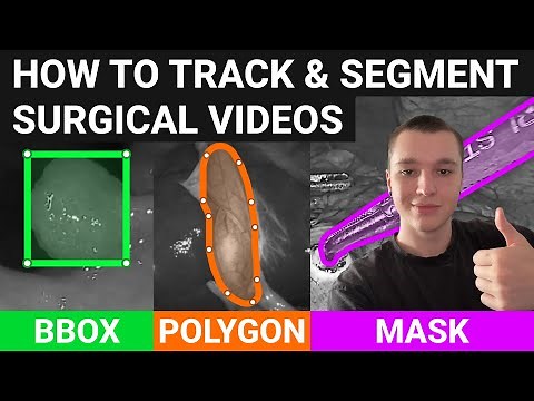 How to annotate surgical videos fast using neural networks