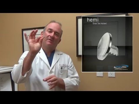 Toe Joint Replacement Surgery San Diego