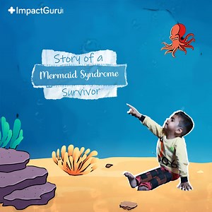 Journey through the unimaginable story of Hammad, born with rare Mermaid Syndrome. With the help of ImpactGuru, they raised funds for his life-changing surgery. Today, he stands a chance to walk again. Hammad's journey is an emotional tale of courage, strength, and resilience. #ImpactGuruSuccess #RareDisease #Inspiring #RareCondition #Heartwarming | Impact Guru