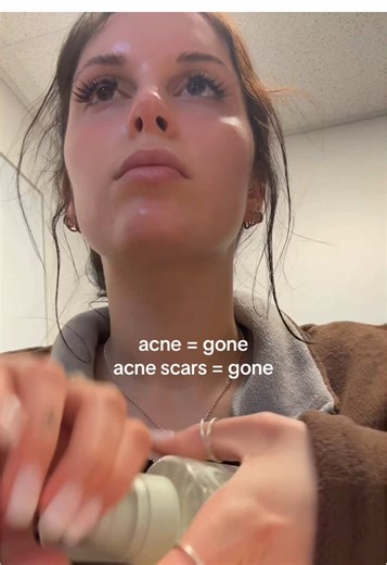 i highly recommend General Medicine if you're struggling with acne prone skin!! #generalmedicine #skincaretips #clearskin #womenshealth #glowup