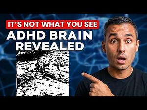 Why the ADHD Brain Sees the World Differently
