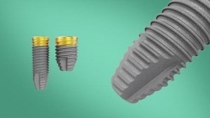 NobelParallel™ Conical Connection | Nobel Biocare United States