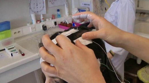 L'électro-encéphalogramme vidéo de longue durée