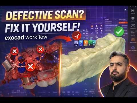 Fix Incorrect Intraoral Scans in Exocad | Step-by-Step STL Repair
