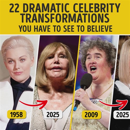 22 Dramatic Celebrity Transformations You Have to See to Believe | Bright Side