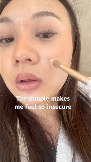 This pimple made me feel so insecure