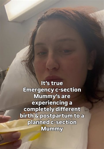 Wouldn’t change it not but definitely a very hard one to swallow at first #csectionmom #relatable #birthstory #birth