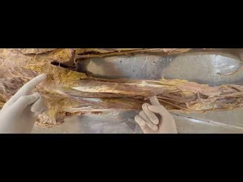 Dissection of hamstring muscles || Anatomy of hamstring muscle || Hamstring muscles