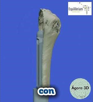 IMPLANTES CUSTOMIZADOS