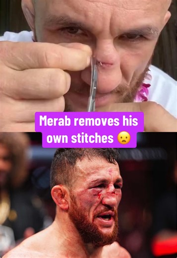 Merab Dvalishvili removes his own stitches that he got after his bout with Petr Yan 😳 (via merab.dvalishvili/IG) #ufc #mma #merabdvalishvili