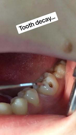 #foryou #viral #tiktokuganda🇺🇬🇺🇬🇺🇬 #kampala