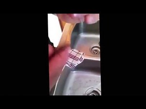 Bad splinter removal