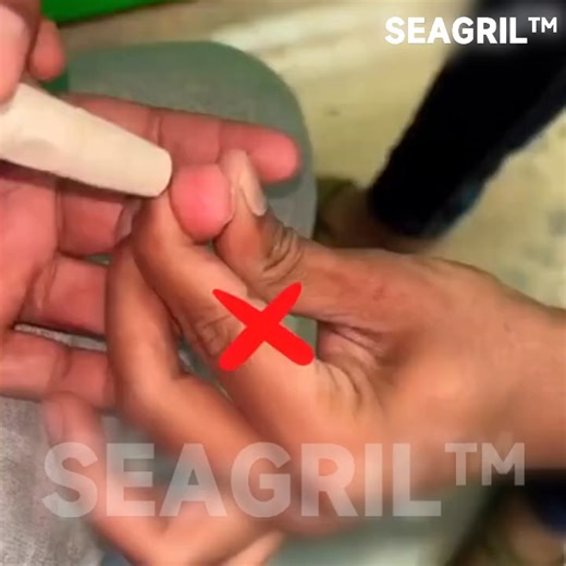 🌟 Tired of painful finger pricks? Meet SEAGRIL™ Non-Invasive Glucose Monitor — 99.9% accuracy, no needles, no strips, no stress. TGA approved ✔️ Comes with an exclusive free gift today 🎁 | Silencer Shop-US