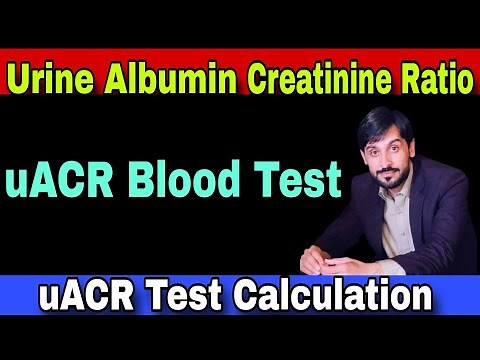 Urine Albumin Creatinine Ratio Test | uACR Test | uACR Test Procedure | uACR Test Calculation