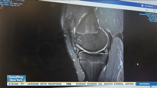 Breakthrough ACL surgery helps patients heal faster