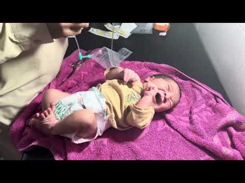 Baby Care | Adorable Newborn NG Tube Pass in NICU Doctor’s Gentle Feeding