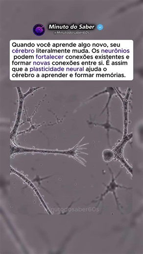 É Isso Que Acontece No Seu Cérebro Quando Você Aprende Algo Novo 😳