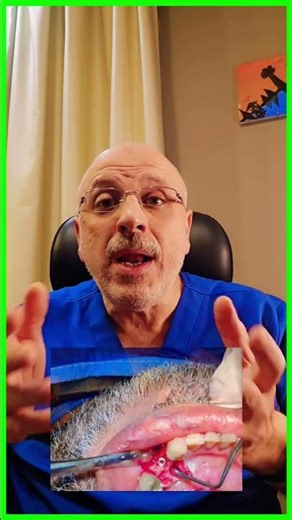 المرشد الجراحي: أحدث تقنية لزراعة الأسنان بأقل مشاكل ممكنه