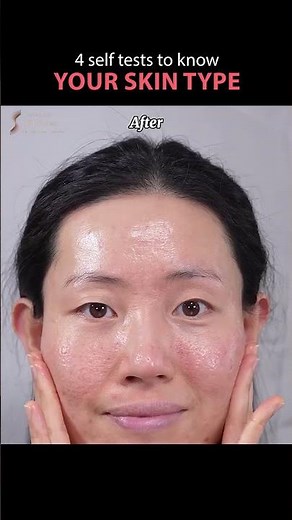 4 Simple Skin Tests to Find Your Skin Type at Home | Dermatologist Explains