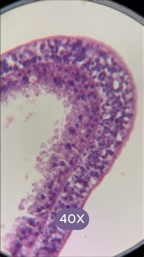 🦠🔬 A microscopic look at Hydra with the AmScope ME580!