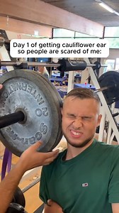 Cauliflower ear is not a ‘badge of honor’—it’s a recurrent auricular hematoma. Repetitive blunt trauma shears the perichondrium from the cartilage, disrupting blood supply. Without prompt drainage and compression, fibrocartilage overgrowth permanently deforms the pinna. ✅Follow @drdavidabbasi for More Daily Medical Content & Health Tips! 🌴😷Schedule a consultation to see Dr. Abbasi as a patient in Delray Beach! Visit www.primeorthocenter.com | David Abbasi, MD - Sports Medicine & Orthopedic Sur