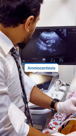 #dralbanna #amniocentesis | Dr Wael El Banna