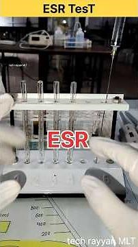 ESR test practical ||#hematology #labtechnician #pathology