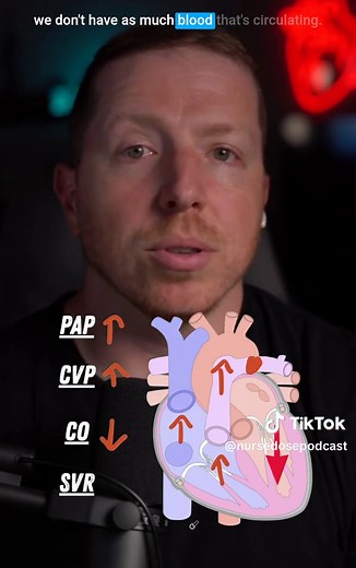 Understanding Hemodynamics of Pulmonary Embolism