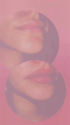 Baby Russian lips. What It Is: • The “Russian lip technique” is a lip filler method that creates a more defined, vertically oriented pout with emphasis on the cupid’s bow and lip borders rather than just volume. • The “Baby Russian” is a softer, more natural version of this. It gives subtle definition and lift, especially to the upper lip, without looking overdone. Think enhancement, not exaggeration. #lipfiller #lipfillers #lipfillerbeforeandafter #russianlip #russianlips💉 | Violetsky Highlife