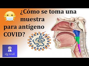 Como se toma la muestra de antígeno COVID? Exudado nasofaríngeo