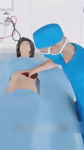 ¡El cirujano q tenía q salvar a una paciente hizo lo impensable! 😱#fact #funfacts #factory #historyfacts #interestingfacts