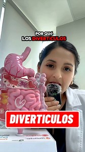 Los divertículos aparecen con mayor frecuencia en el COLON SIGMOIDES (LADO IZQUIERDO) porque es el tramo que trabaja con MAYOR PRESIÓN y tiene un DIÁMETRO MÁS PEQUEÑO. Si tienes diverticulos? Cuénteme en los comentarios #diverticulos #diverticulitis #colon #SaludDigestiva #gastroenterologia | Dra. Veronica Mena - Gastroenteróloga