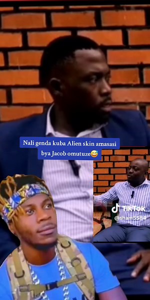 Discover Alien Skin: Uganda's Unique Cultural Phenomenon