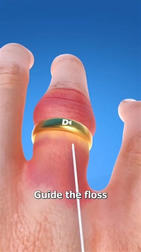 How to Remove a Stuck Ring Easily 😱💍 #Shorts
