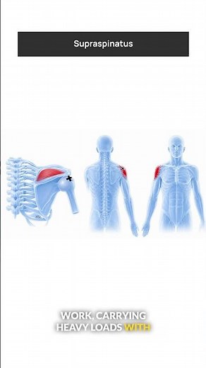 Supraspinatus Trigger Points: Shoulder & Arm Pain