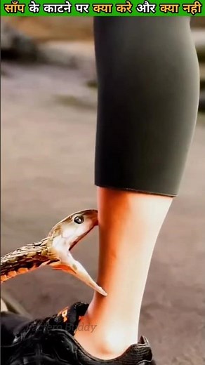 “What To Do If a Snake Bites You 😱🐍 | Life-Saving First Aid Tips!”