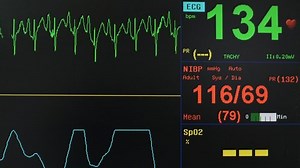 clip-15047953-vital-signs-monitor
