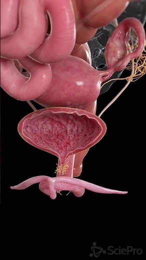 Cystitis: What Happens to the Bladder Wall #Shorts #Anatomy