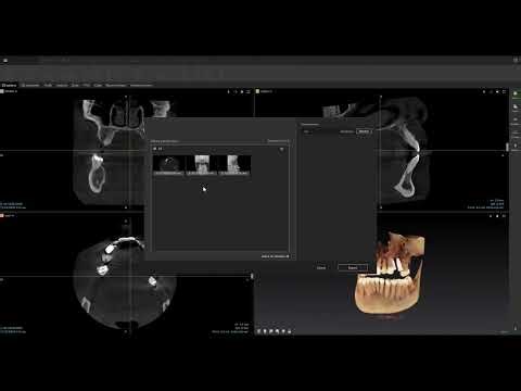 Step-by-Step Guide: Exporting CBCT Volumes to DICOM Using DTX Studio
