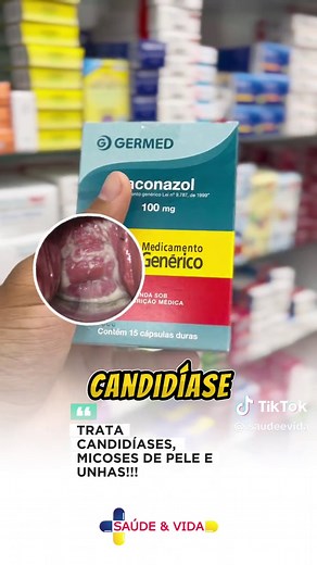 Tratamento de Micoses com Itraconazol: Eficácia e Cuidados