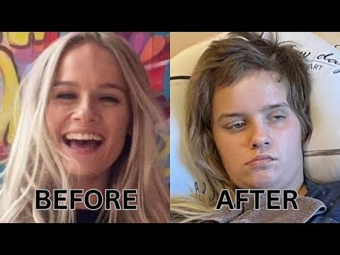 This Is What Happened After Her Boyfriend Got Angry… 😔