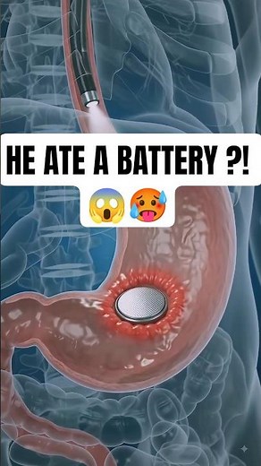 What Happens If You Swallow a Battery? 😱🤯 #shorts #battery