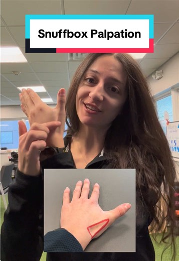 The anatomical snuffbox is one of the first places clinicians check when we’re concerned about a scaphoid fracture, especially after a fall Tenderness in this area doesn’t automatically mean you fractured the scaphoid, but it is a major red flag. Because the scaphoid has a limited blood supply, missed or delayed diagnosis can lead to prolonged healing or complications That’s why early imaging, immobilization, and protection matter… even if initial X-rays look normal! If pain here sticks around a