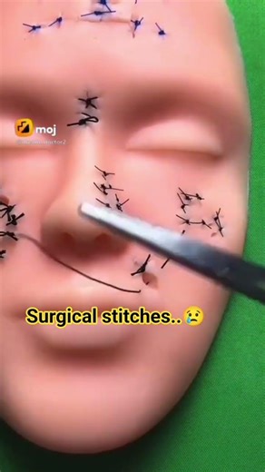 @Sutures & suturing techniques# surgical stitches..✨
