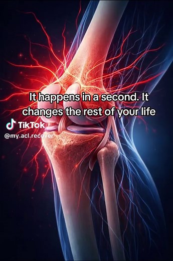 ACL injury #acltear #aclinjury #acl #viral #aclrehab | what does an acl do