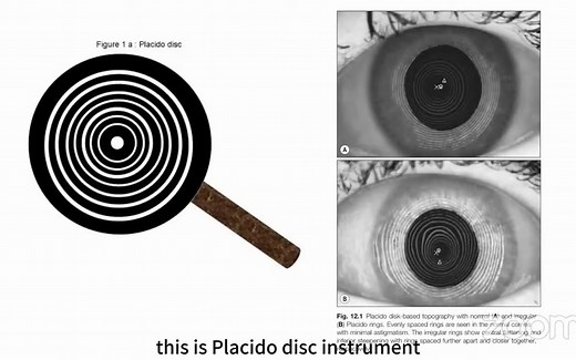 角膜地形图 讲解